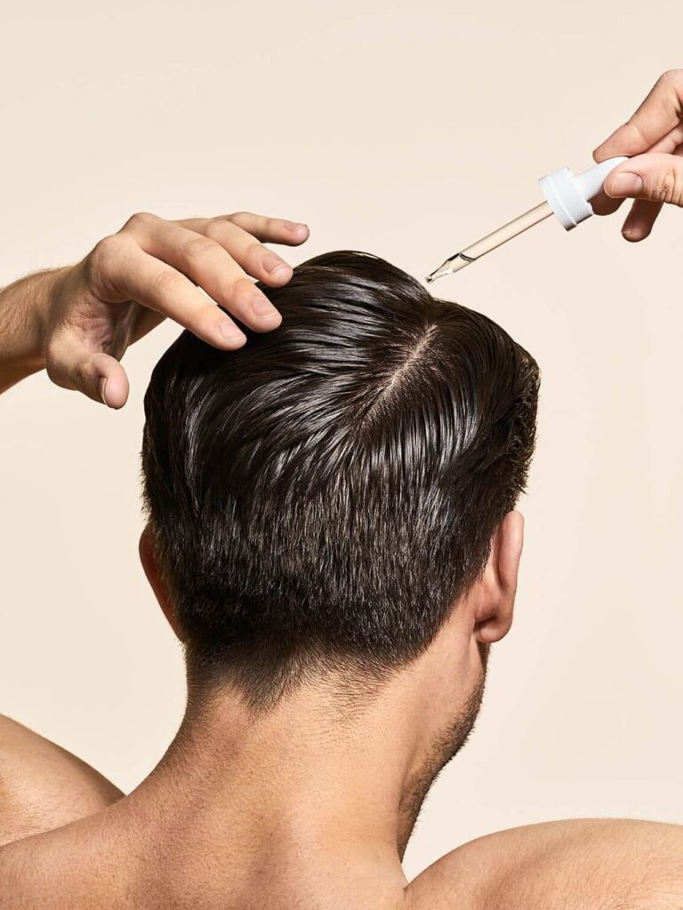 how common is minoxidil shedding
